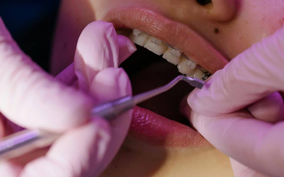Teeth Ignored Will Be Lost: The Silent Danger of Delaying Dental Care