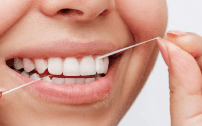 How to Floss Your Teeth: A Step-by-Step Guide