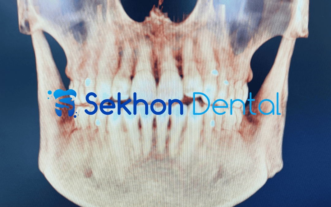 The Future of Dental Care: Embracing Digital Dentistry at Sekhon Dental in Agoura Hills