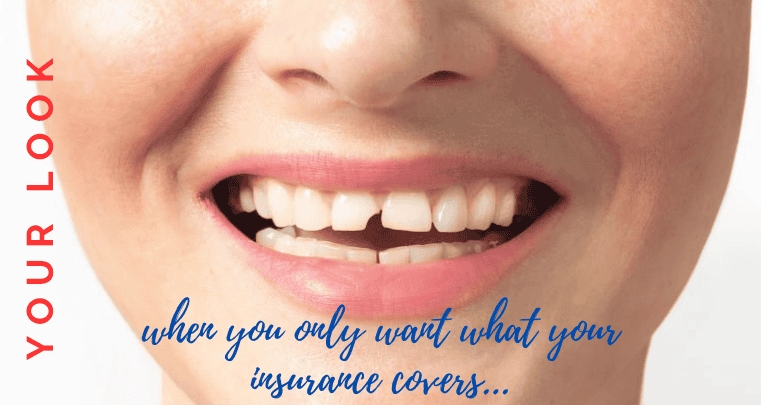 “I Only Want What My Insurance Covers” – The Truth About Dental Insurance and Your Oral Health