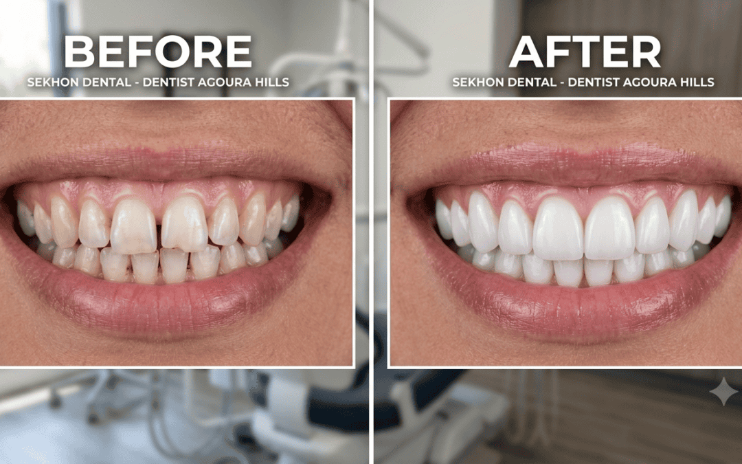 The Cost of Waiting: Why Time is the Most Precious Asset for Your Smile (and Your Confidence)