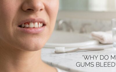 The Silent Smile Killer: Why Your Gums Bleed (And How to Stop It Fast)