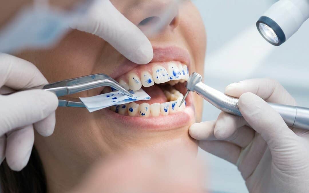 Balancing Your Smile: Why Occlusal Adjustment is Like a Wheel Alignment for Your Teeth